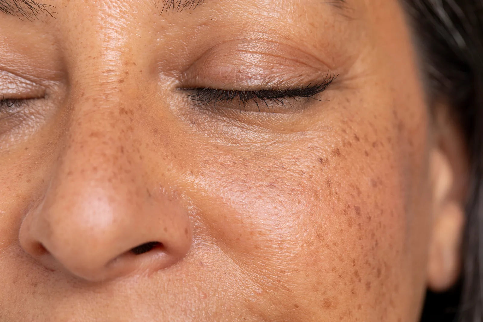 Gros plan sur une peau réactive en lumière naturelle, illustrant l'intolérance cosmétique